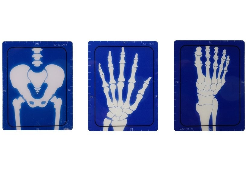 Speelset Dokterset met apparatuur – Interactief