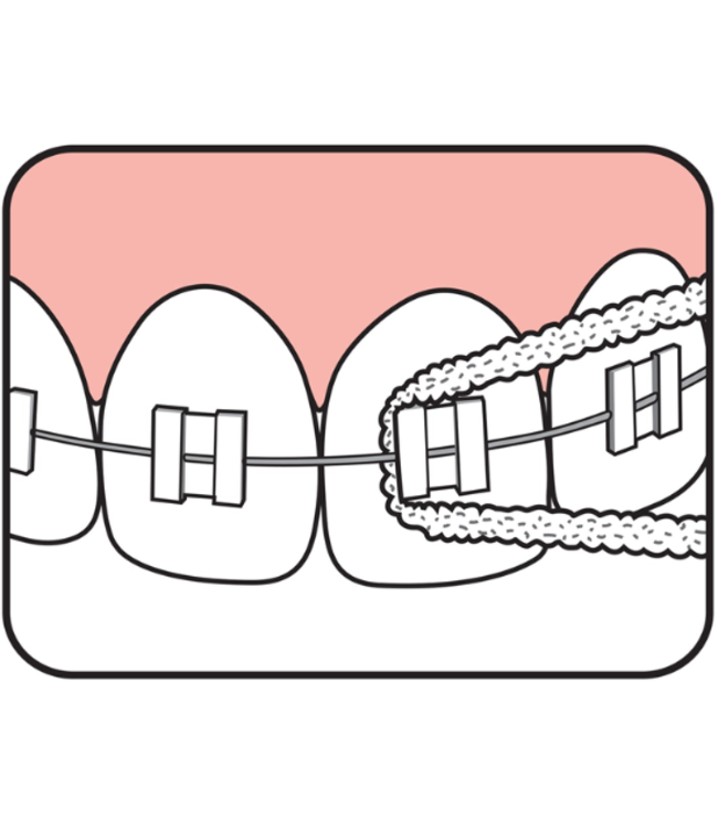 TePe Bridge & Implant Floss 30 stuks