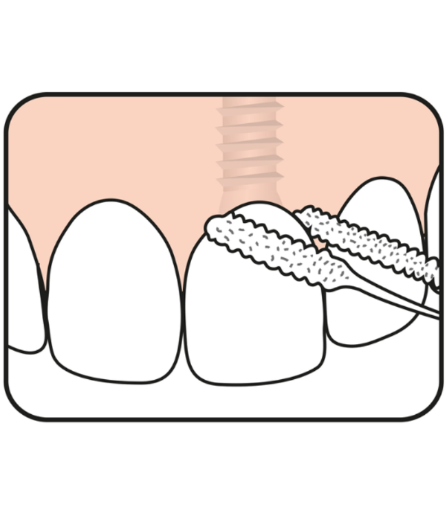 TePe Bridge & Implant Floss 30 stuks