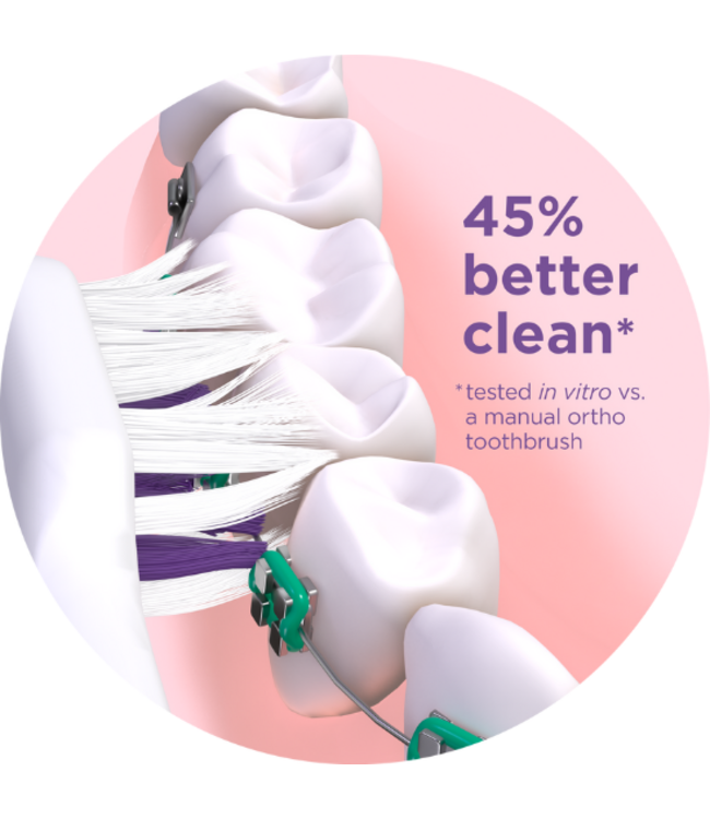 GUM Sonic Ortho Wit - Batterij Tandenborstel
