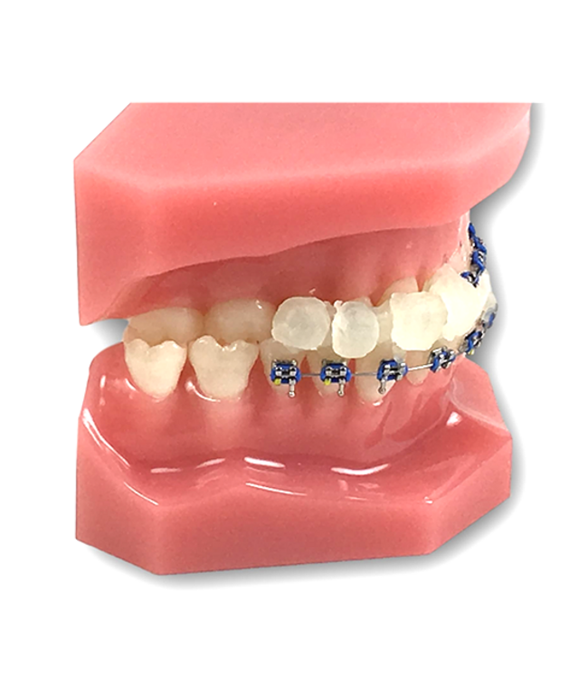 GUM Ortho Wax - voor beugels