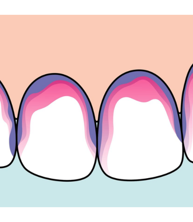TePe PlaqSearch Disclosing plakverklikkers - 10 stuks