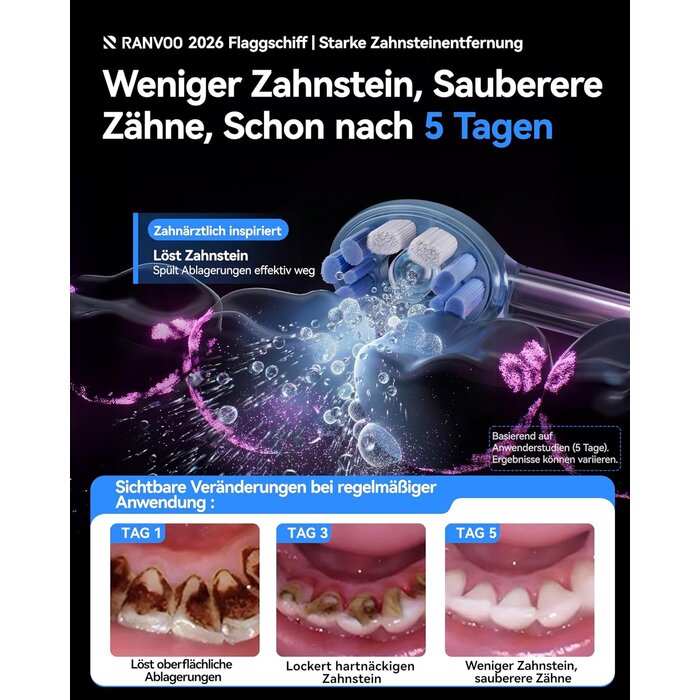 Innovative Schallzahnbürste mit BubbleJet - jetzt bis zu 78% sparen