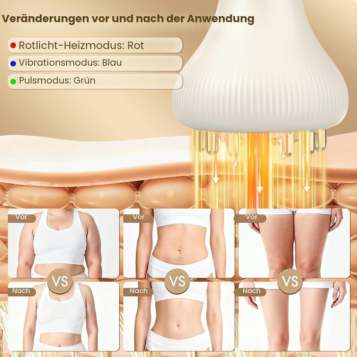 Elektrisches Anti-Cellulitis Massagegerät - 31% Rabatt - Kabellos & Effektiv