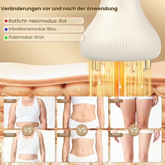 Elektrisches Anti-Cellulite Massagegerät mit 31% Rabatt