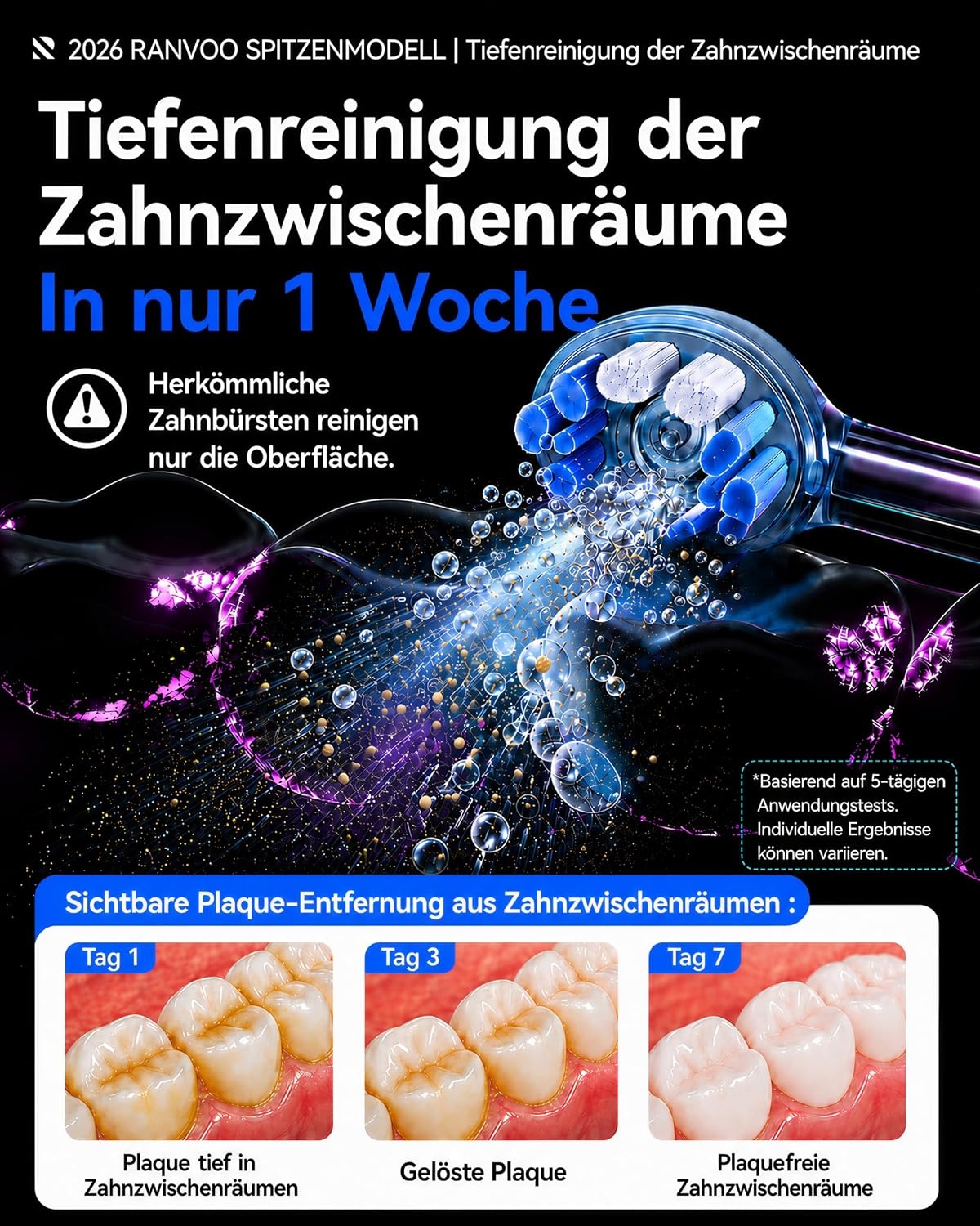 Schallzahnbürste mit BubbleJet-Technologie - Dunkelgrau - 34% Rabatt