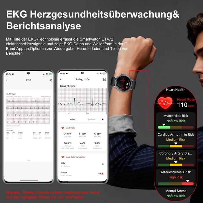 Smartwatch 1,53 Zoll mit EKG & Blutdruckmessung - 33% Rabatt