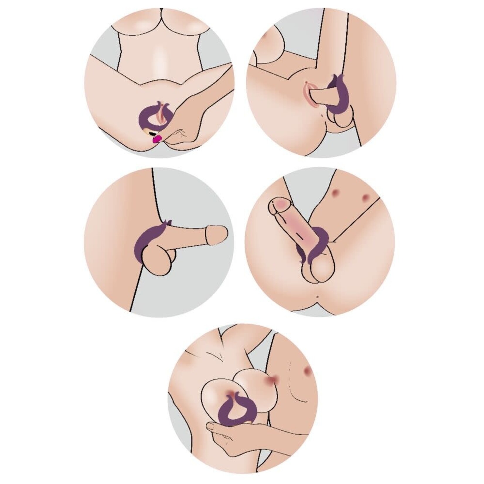 Two motors couple’s ring