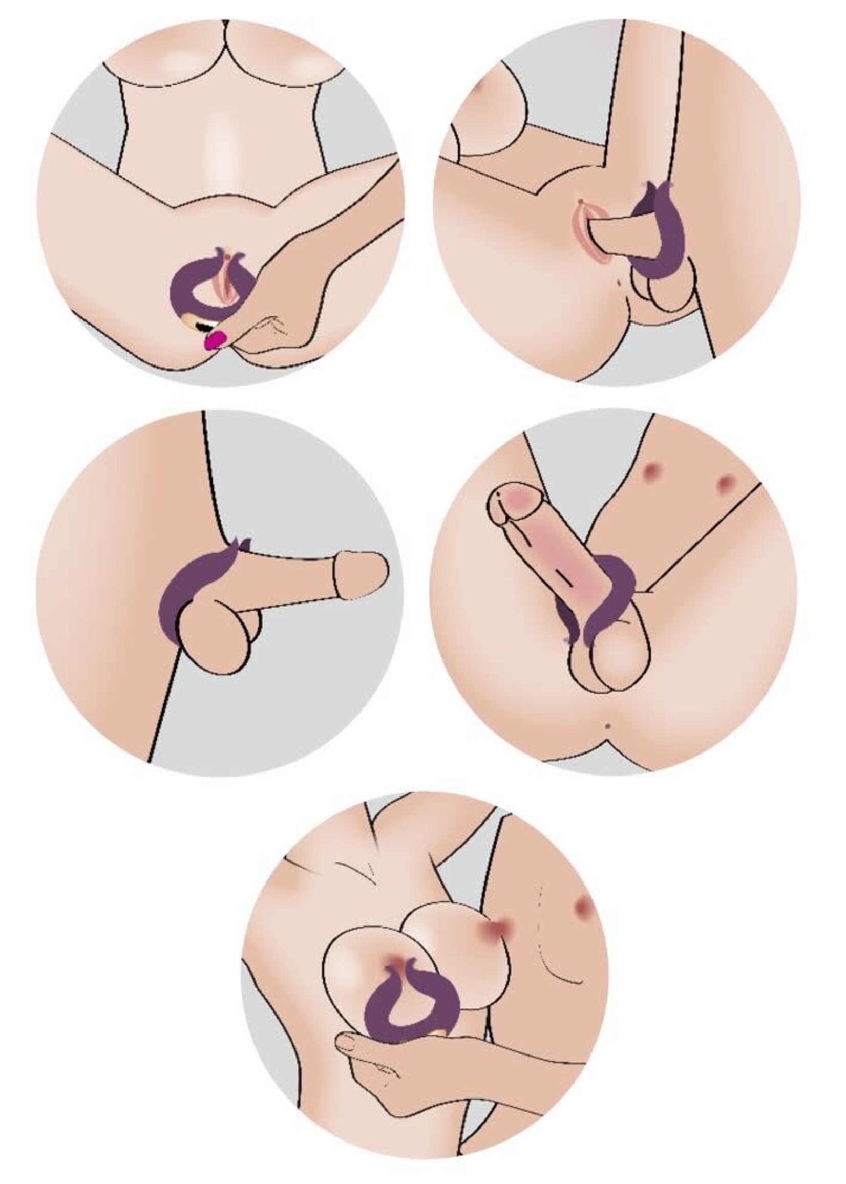 Two motors couple’s ring