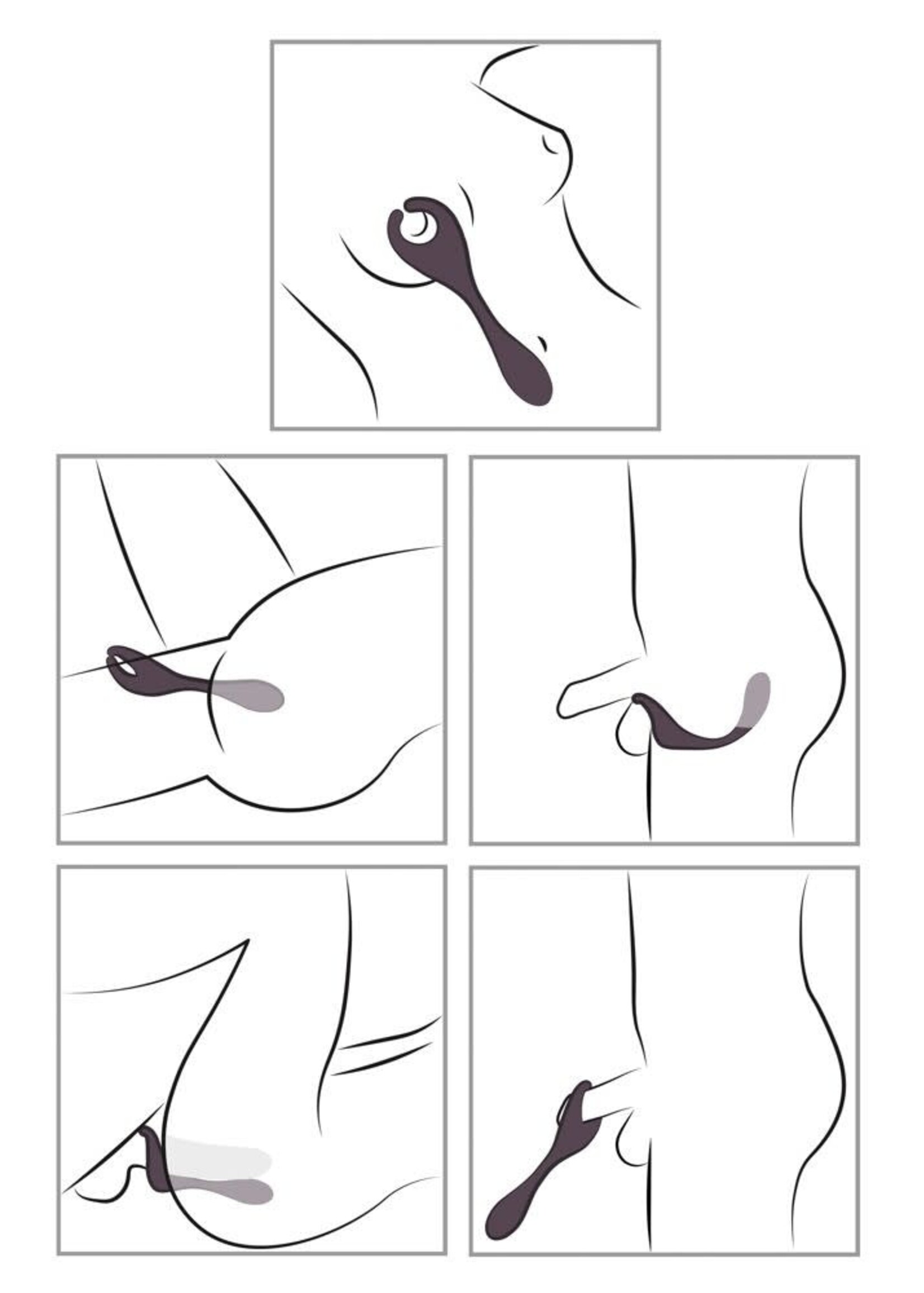 Remote controlled couple's vibrator