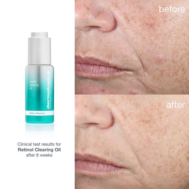 Dermalogica Retinol clearing oil - DERMALOGICA