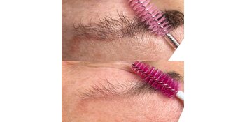 Permanente make up verwijderen zonder laser