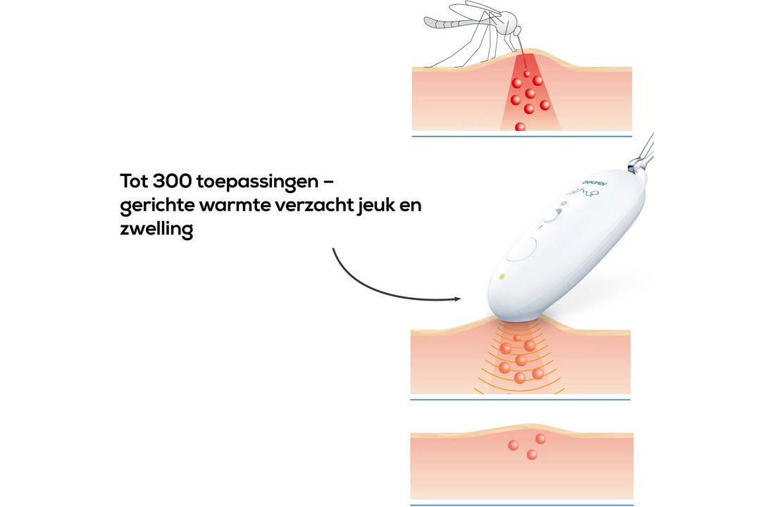Beurer BR 10 - Insectenbeetheler