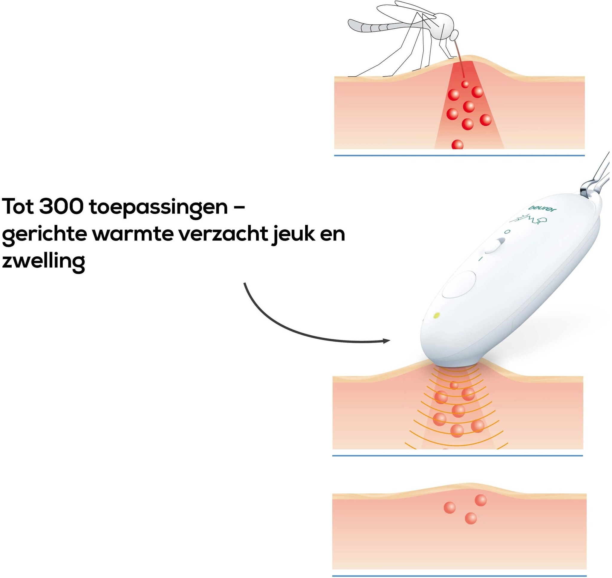 Beurer BR 10 - Insectenbeetheler