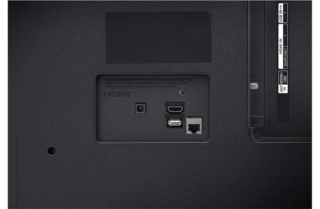 LG 43UR75006LK - LED TV