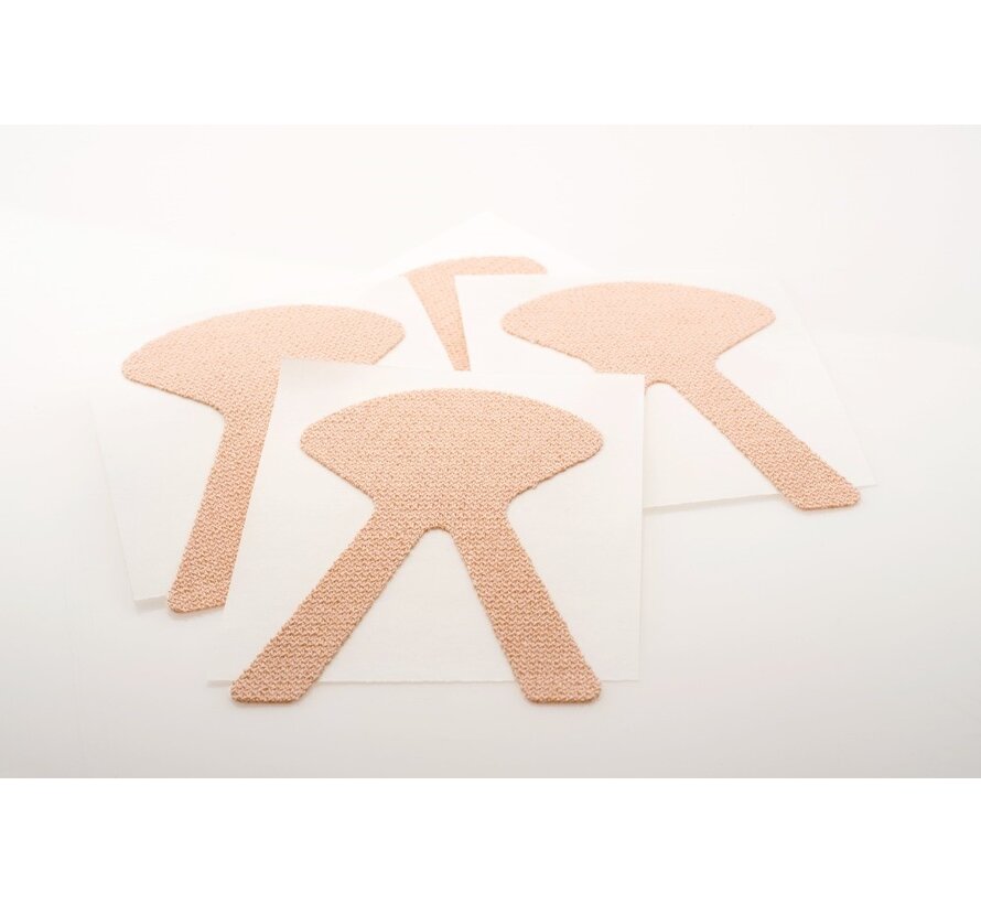 Neussonde fixatiepleister voor kinderen – veilige en comfortabele sondebevestiging