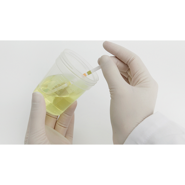 Roche combur 9 teststrips - 50 stuks