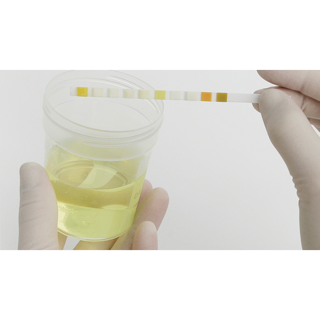 Roche combur 9 Teststreifen - 50 Stück