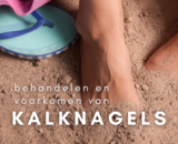 Kalknagels; de beste manier om ze te behandelen en te voorkomen!