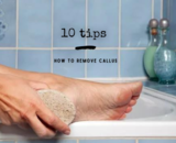 Remove calluses; 10 tips to make and keep your feet free of callus!