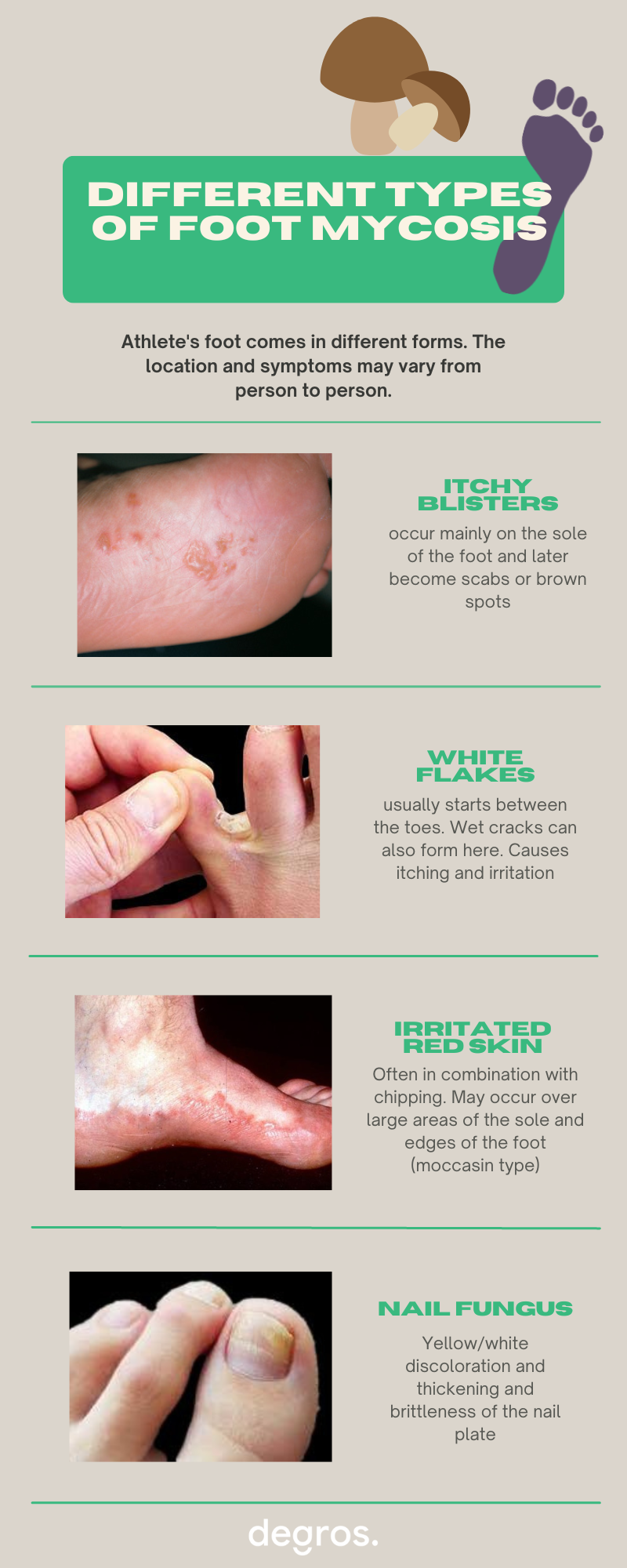 How to Prevent Calluses, Blisters, Athlete's Foot, and Other