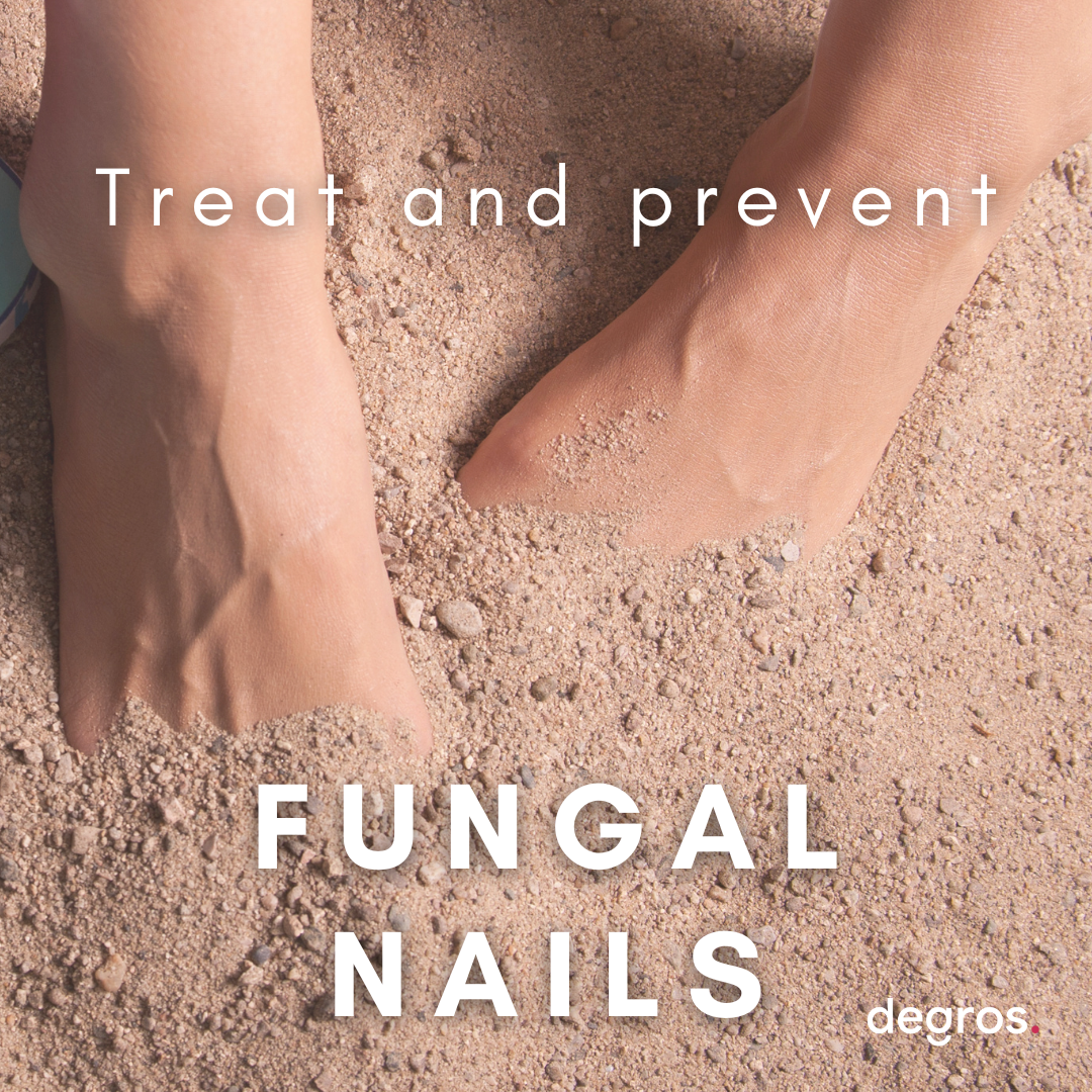 Fungal nails; the best way to treat and prevent them!