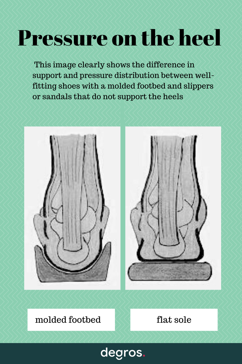 pressure on the heel (cracked heels)