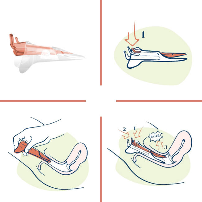 Elleloom Femiscope Speculum