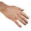 Steri-Strip Wundverschlussstreifen 6 x 38 mm – 10 Streifen