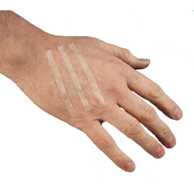 Bandes de suture cutanée Steri-Strip 6 x 38 mm – 20 bandes