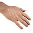 Steri-Strip Wound Closure Strips 6 x 38 mm – 20 Strips