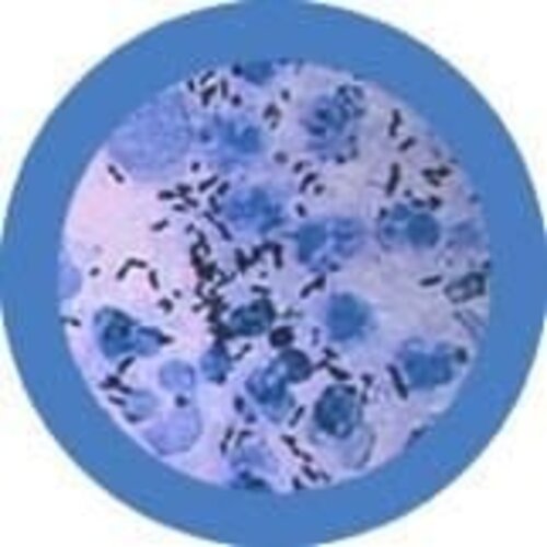 Giantmicrobes Giant Microbes - The Clap/Gonorrhea (Neisseria gonorrhoeae)