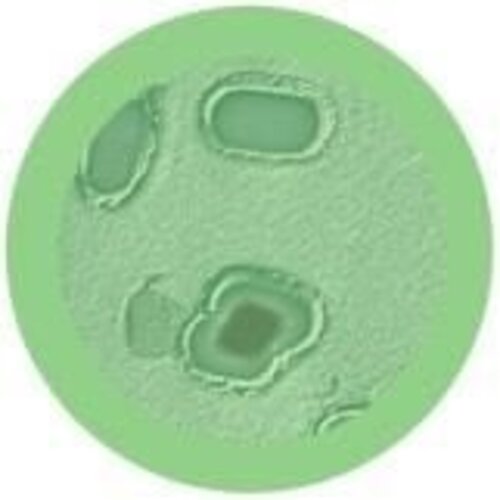 Giantmicrobes Giant Microbes - Gangrene (Clostridium perfringens)