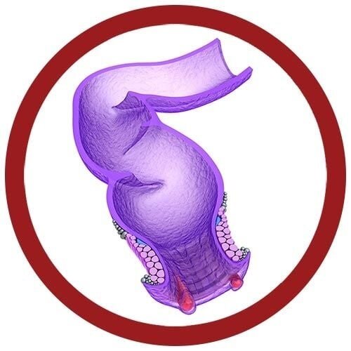 Giantmicrobes Giant Microbes - Hemorrhoids