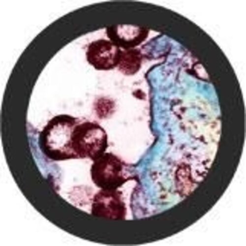 Giantmicrobes Giant Microbes - HIV (Human Immunodeficiency Virus)