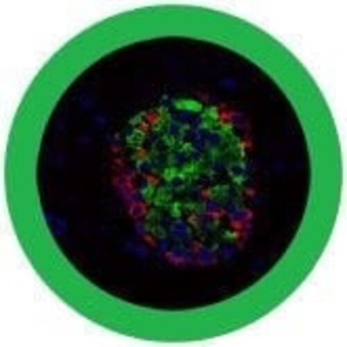 Giantmicrobes Giant Microbes - Diabetes (Pancreatic Beta Cell + Insulin)