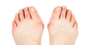 Hardloopschoenen voor brede voeten!