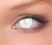 Blind White 14mm Crazy kleurlenzen (1 jaar) Blind White 14mm Crazy kleurlenzen (1 jaar)