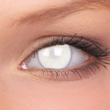 Blind White 14mm Crazy Colored Contact Lenses (1 year)