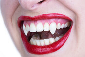Small Sexy Deluxe Vampire Fangs Small Sexy Deluxe Vampire Fangs