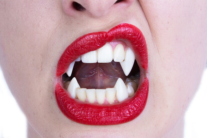 How to Apply: Vampire Fangs 
