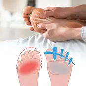 Tuli's Soft Moves Teenspreider - 1 paar