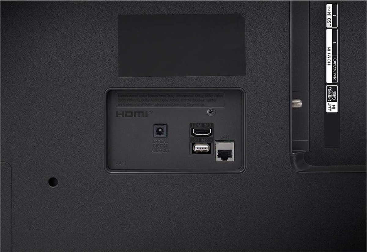 LG 43UR75006LK - LED TV