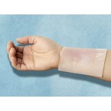 Detectaplast Burn Gel Dressing 20x20cm (6 stuks)