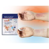 Detectaplast Burn Gel Dressing 10x10cm (20 stuks)