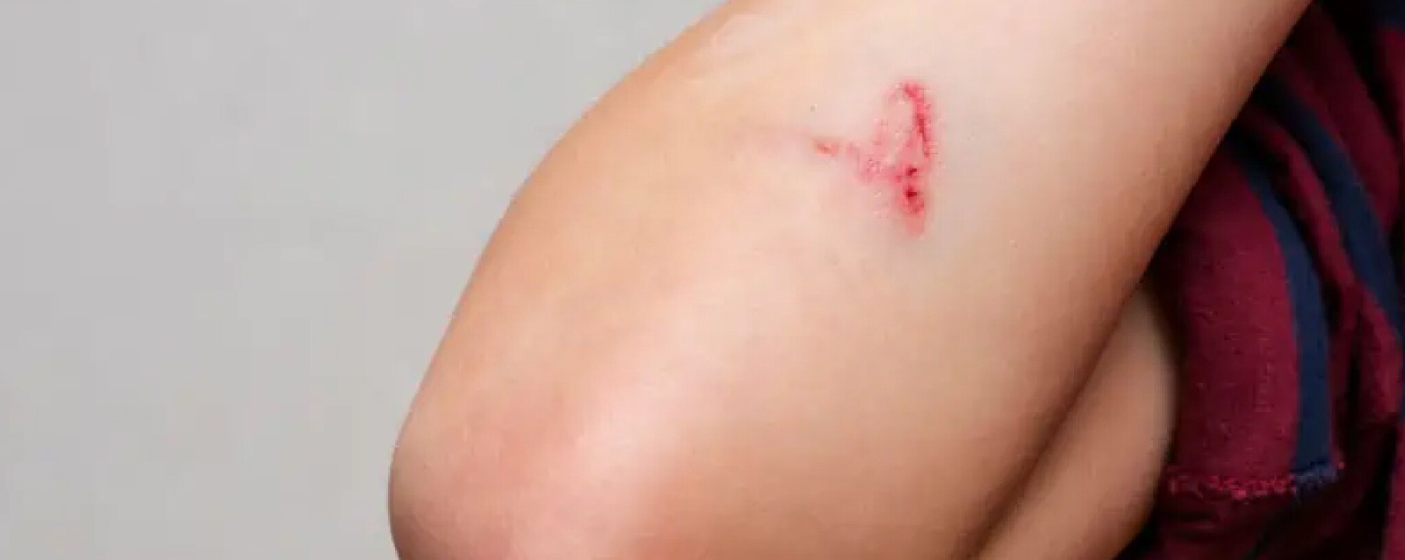 Schaafwonden verzorgen: 3 essentiële stappen voor een optimaal herstel 