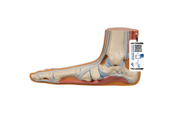 3B Pes Planus - Voetmodel (M31)