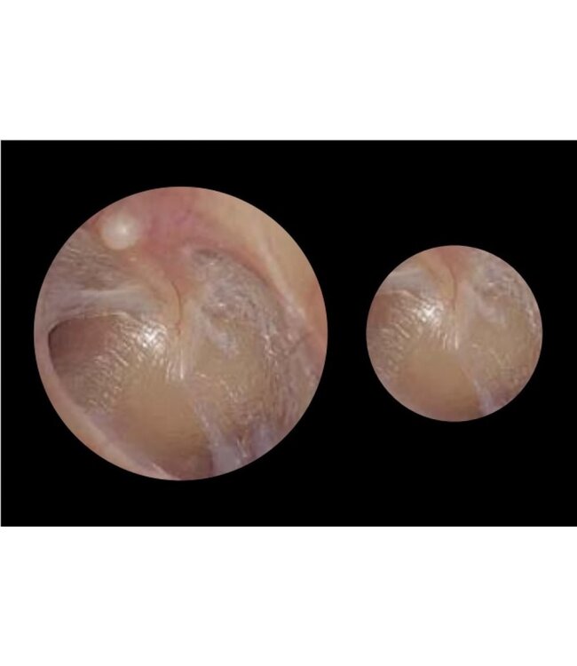 Diagnostix™ Otoscoopkop 3.5V - PMV