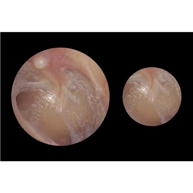 ADC Adstation ™ 5681 3.5V PMV otoscoop voor aan de muur