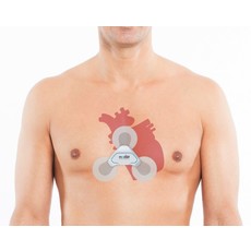 Medset ECG Time S  Enregistreur Mini Holter – une nouvelle dimension de confort et de performance